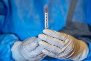CDC Sebut Hantavirus Sangat Sulit Menular dari Orang ke Orang