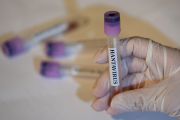 Belarus Catat 50 Kasus Hantavirus Setiap Tahunnya