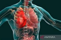 Dokter Ungkap Lima Kebiasaan Sederhana untuk Kurangi Peradangan