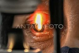 Pemkot Jakbar Gelar Operasi Katarak Gratis pada 11 April