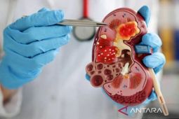 Dehidrasi hingga Hipertensi Bisa Jadi Faktor Penyebab Gagal Ginjal