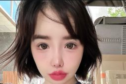 Park Bom klarifikasi kondisi setelah ramai isu dari agensi soal kesehatannya