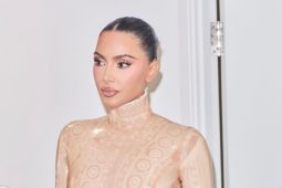 Kim Kardashian ungkap dirinya didiagnosis derita aneurisma otak