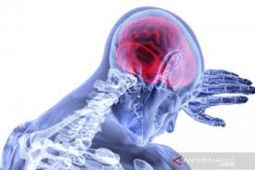 Dokter RSUI Ungkap Faktor Pemicu Stroke, dari Genetik hingga Gaya Hidup