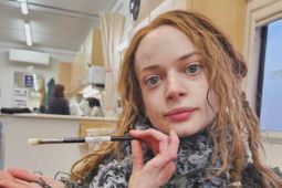 Ruth Codd jalani amputasi kedua: Kisah jujur aktris “How To Train Your Dragon”