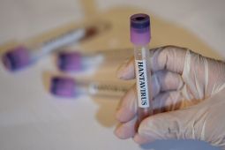Belarus Catat 50 Kasus Hantavirus Setiap Tahunnya