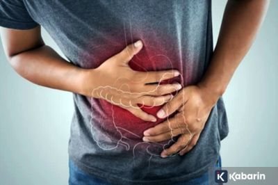 Kasus Kanker Usus di Indonesia Banyak Menyerang Anak Muda