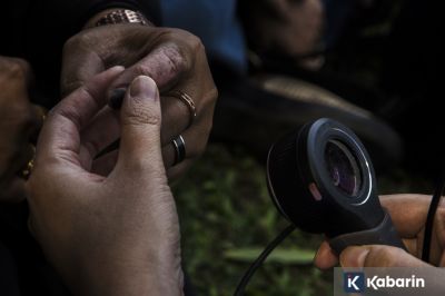 Cara Mencegah dan Menangani Autoimun yang Perlu Diketahui