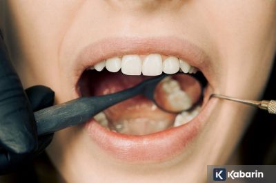 Jangan anggap remeh gusi berdarah, itu bisa jadi tanda peradangan