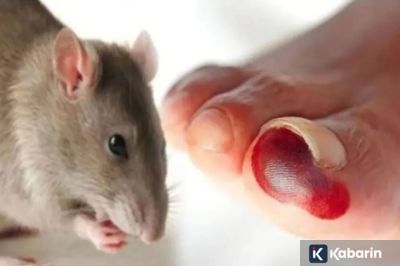 Waspada! Virus Hanta Bisa Menular dari Debu Kotoran Tikus