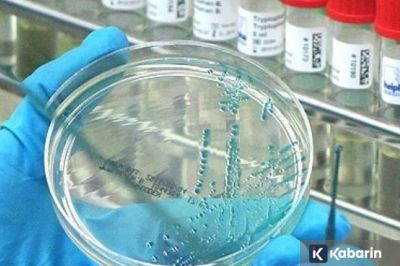 Ilmuwan Rusia Buat Vaksin Baru Lawan Flu Burung H5N1