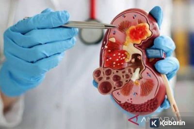 Dehidrasi hingga Hipertensi Bisa Jadi Faktor Penyebab Gagal Ginjal