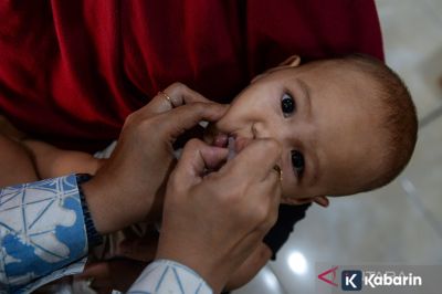 Pipi bengkak bikin panik, begini cara atasi gondongan dari rumah