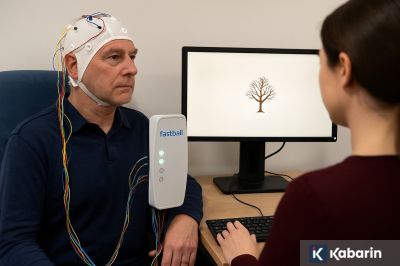 Otak pria menyusut lebih cepat, tapi risiko Alzheimer justru lebih tinggi pada wanita