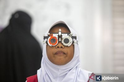 Dokter Ingatkan Orang Tua Waspadai Kelainan Kelopak Mata pada Anak Sejak Lahir