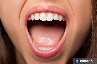 Penjelasan mengenai gusi bengkak, serta gejala peradangannya