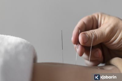 Akupuntur Wajah Bikin Kulit Jadi Lebih Cerah dan Segar