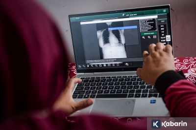 Pasien TBC Disarankan Konsumsi Obat Secara Konsisten