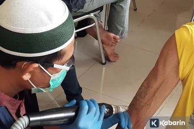 Pastikan Kondisi Tubuh Sehat Sebelum Hapus Tato
