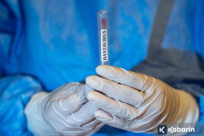CDC Sebut Hantavirus Sangat Sulit Menular dari Orang ke Orang
