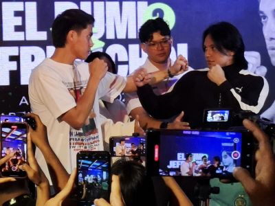 Kenali jenis dan penyebab dislokasi bahu yang dialami Jefri Nichol