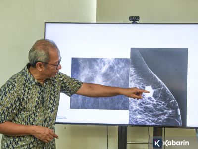 Waspadai perubahan fisik pada payudara yang bisa jadi tanda kanker