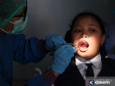 Sakit gigi ternyata bisa jadi tanda gangguan kesehatan lain