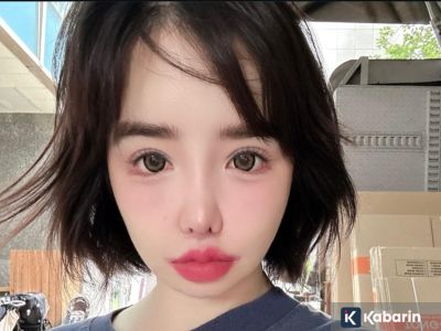 Park Bom klarifikasi kondisi setelah ramai isu dari agensi soal kesehatannya