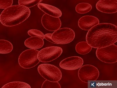 Peneliti ciptakan pembuluh darah 3D untuk ungkap rahasia stroke