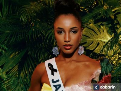 Miss Jamaika masih jalani perawatan di ICU usai jatuh dari panggung