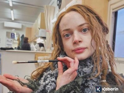 Ruth Codd jalani amputasi kedua: Kisah jujur aktris “How To Train Your Dragon”