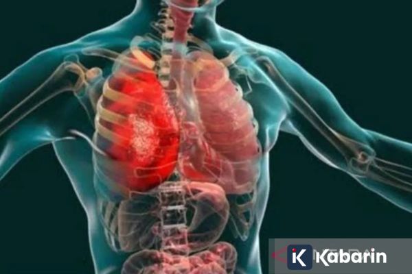 Dokter Ungkap Lima Kebiasaan Sederhana untuk Kurangi Peradangan