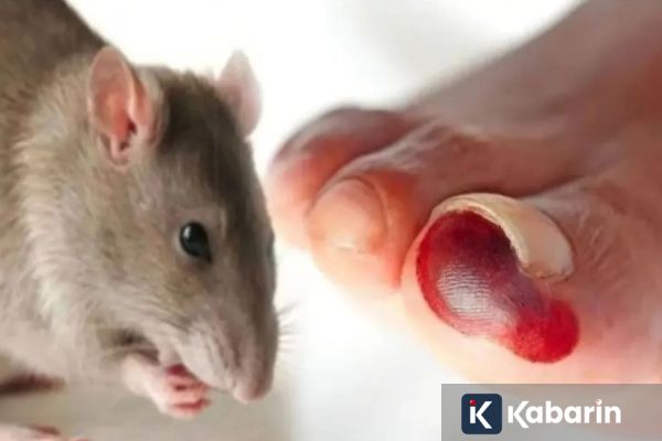 Waspada! Virus Hanta Bisa Menular dari Debu Kotoran Tikus