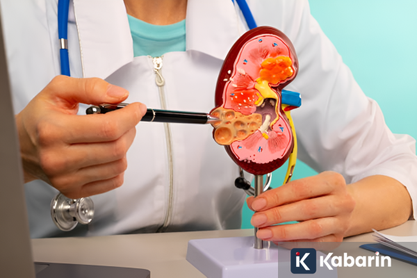 Sederet Faktor hingga Tanda yang Jadi Pemicu Batu Ginjal