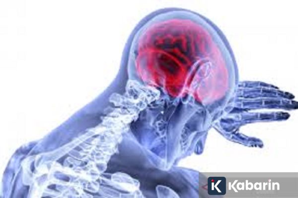 Dokter RSUI Ungkap Faktor Pemicu Stroke, dari Genetik hingga Gaya Hidup