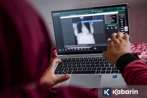 Pasien TBC Disarankan Konsumsi Obat Secara Konsisten