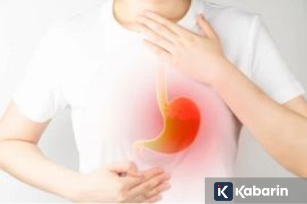 Tips Atasi GERD Saat Mudik Agar Perjalanan Tetap Nyaman