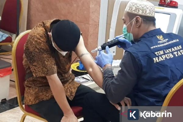 Baznaz DKI Buka Layanan Hapus Tato Gratis Mulai 23 Februari 2026