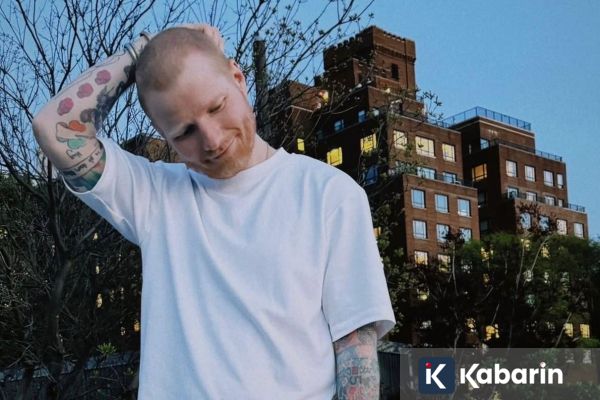 Ed Sheeran Ternyata Sempat Terdiagnosis Herpes 