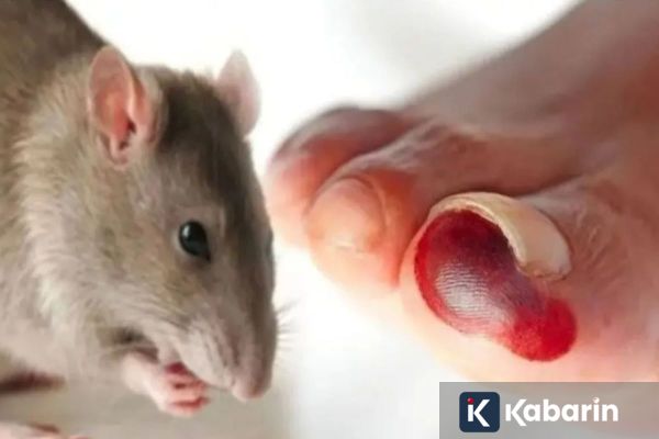 Inilah Gejala Serta Langkah Pencegahan Virus Hanta