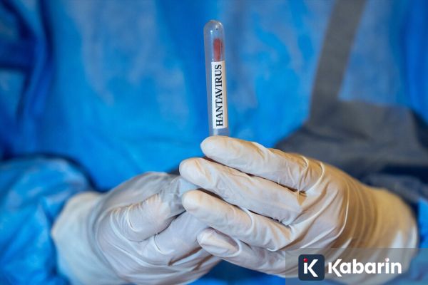 CDC Sebut Hantavirus Sangat Sulit Menular dari Orang ke Orang