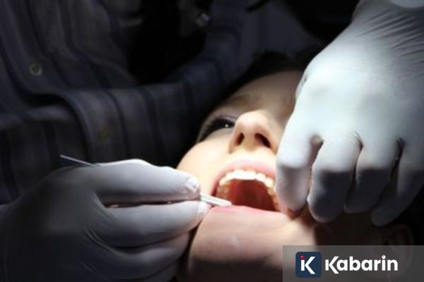 Kebiasaan Merokok Tingkatkan Risiko Kanker Mulut, Ini Penjelasan Dokter