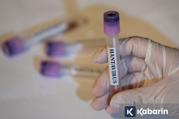 Belarus Catat 50 Kasus Hantavirus Setiap Tahunnya