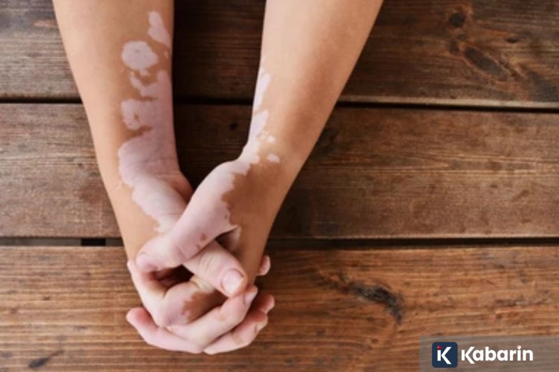 WhatsApp Luncurkan Fitur-fitur Baru untuk Obrolan Grup