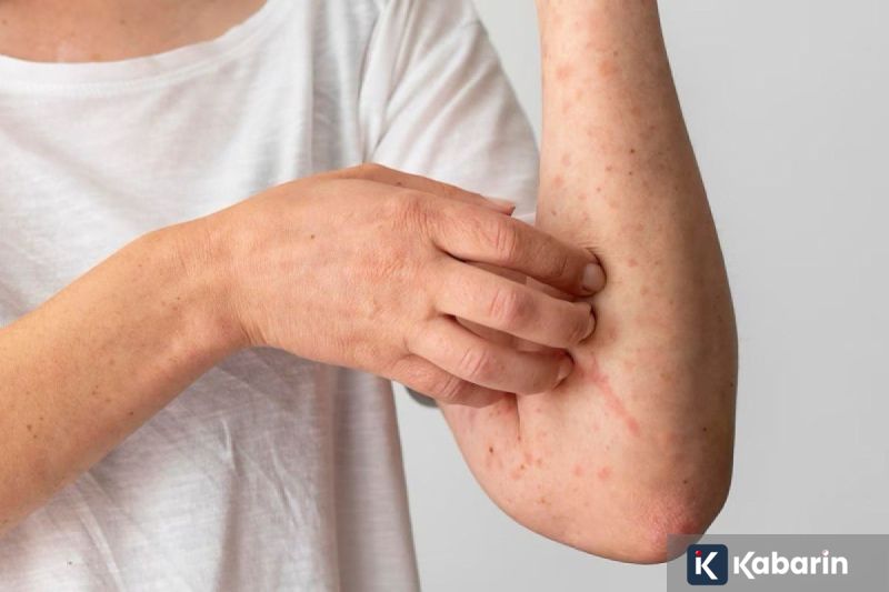 Jarang Cuci Alat Makeup? Ini Bahaya Serius yang Bisa Rusak Kulit