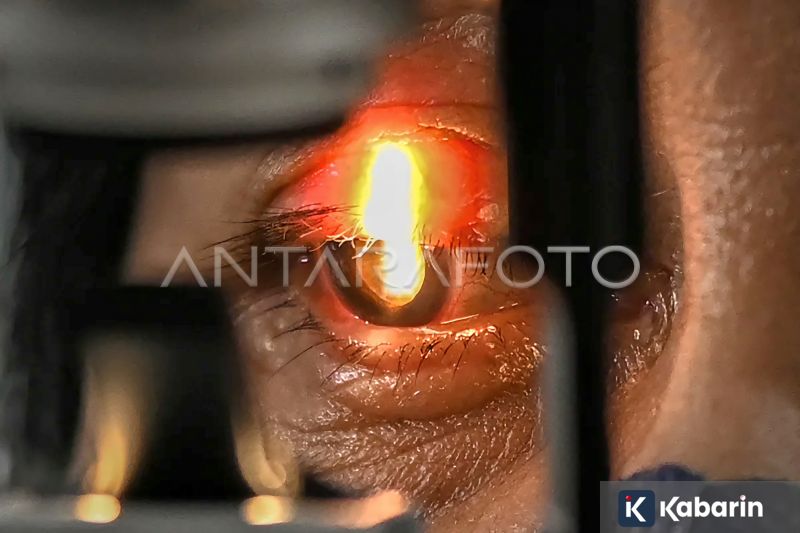 Pemkot Jakbar Gelar Operasi Katarak Gratis pada 11 April