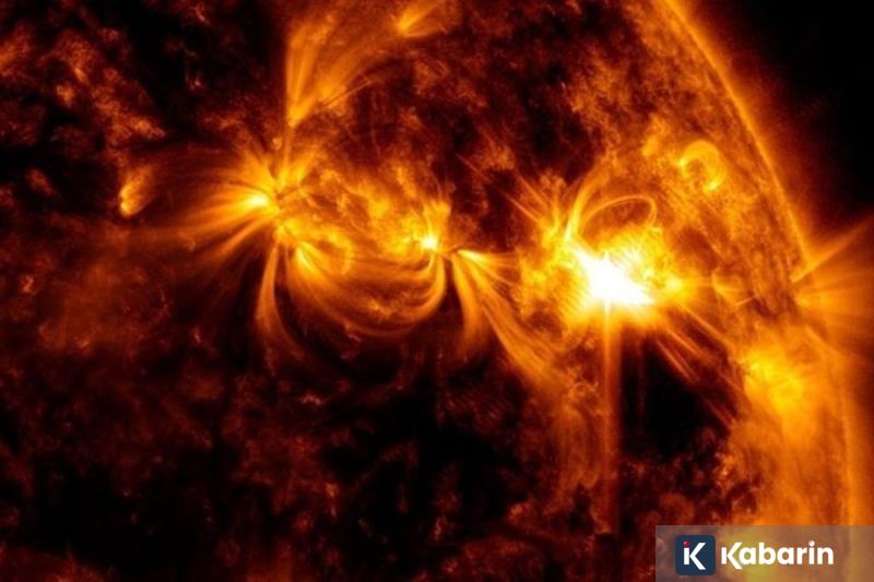 Kenali penyebab serta gejala sakit gigi yang sering muncul berikut ini