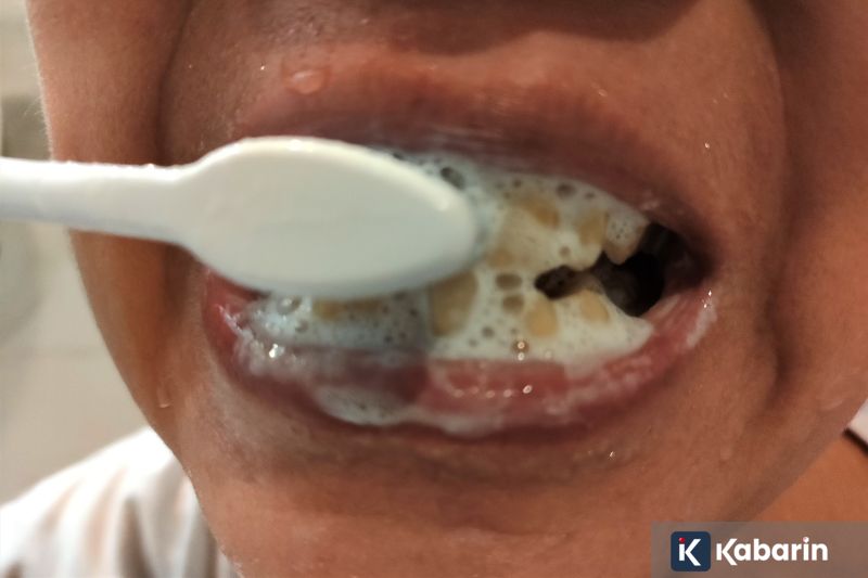 Polri pecat dua anggota Yanma tersangka pengeroyokan di Kalibata