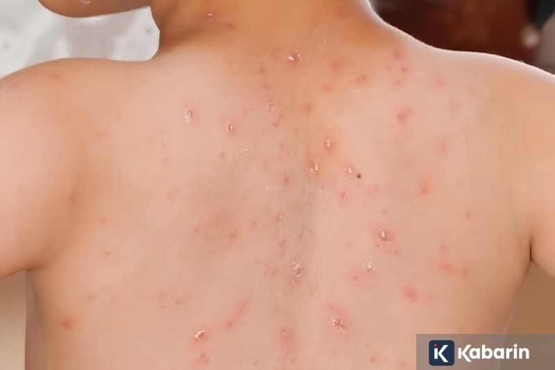 Tiga mantan direksi ASDP resmi bebas berkat rehabilitasi Presiden Prabowo