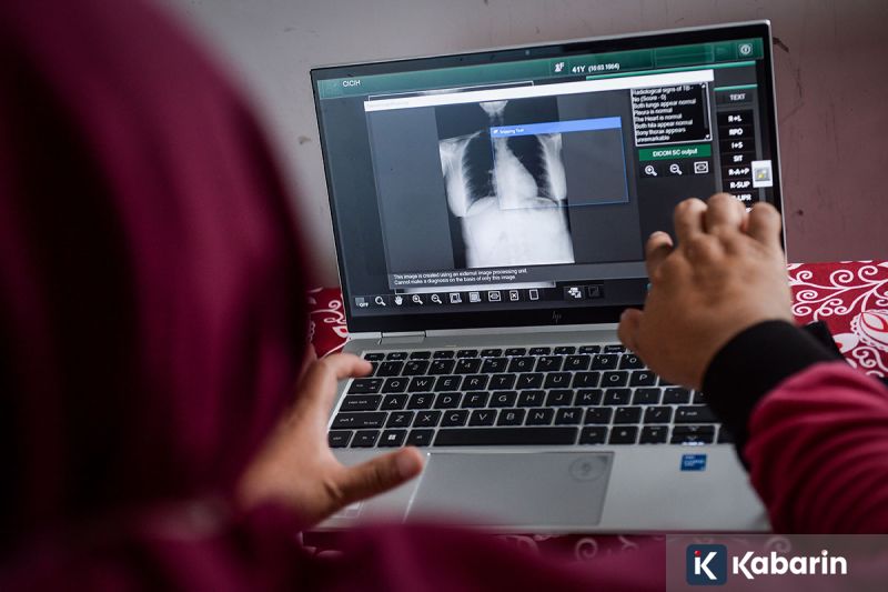 Pasien TBC Disarankan Konsumsi Obat Secara Konsisten